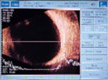Foto - Ultraschall
